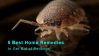 5 Best Home Remedies to Get Rid of Bedbugs